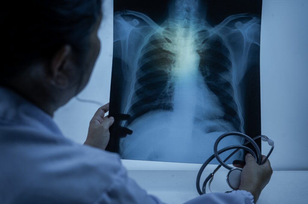 The History of X-rays: Southwoods Imaging 5