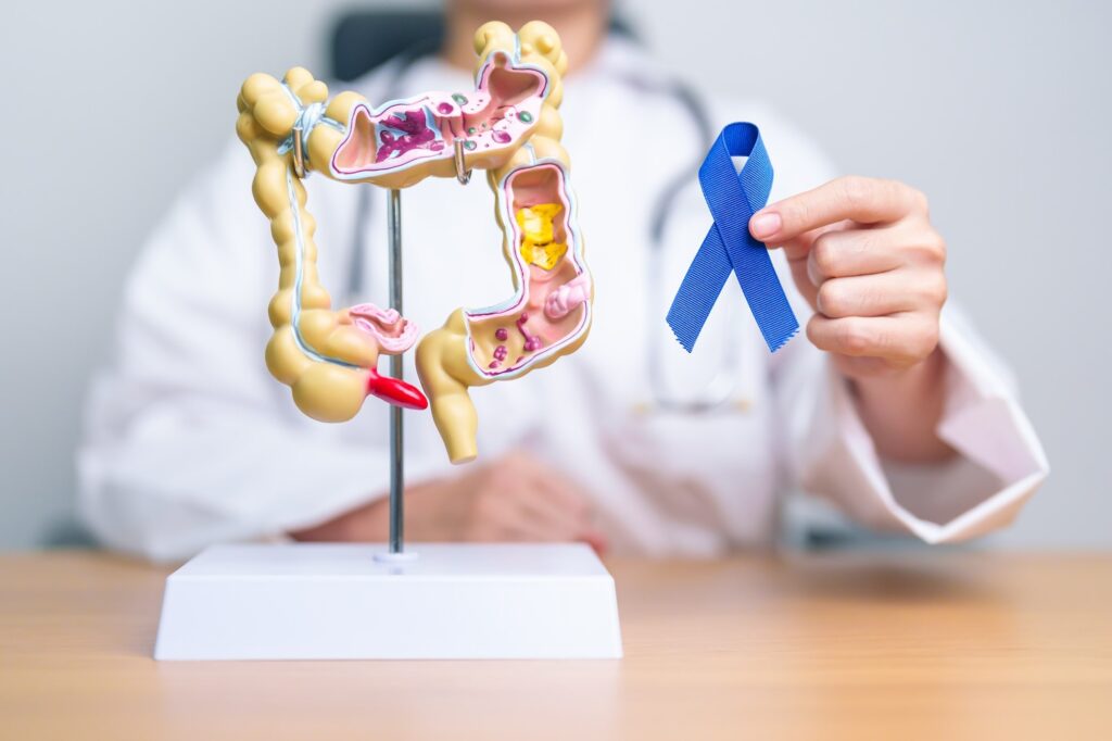 Colorectal Cancer Awareness Month: Signs & When to See Your Doctor 7